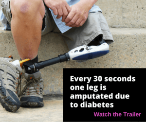 diabetic amputee