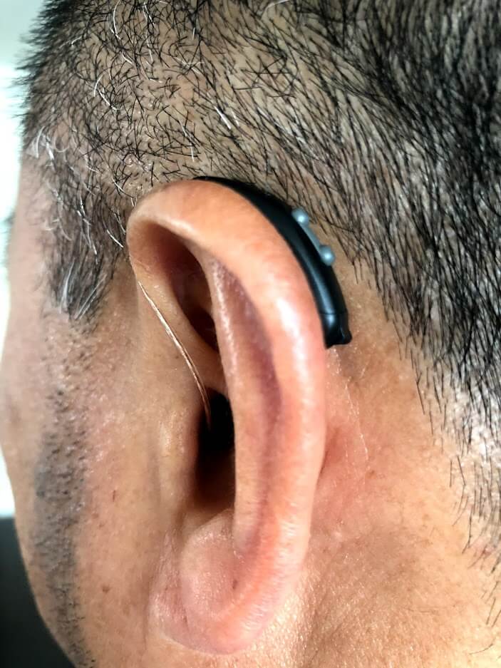 hearing loss